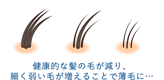 NIȔ̖тAׂアт邱ƂŔтɁc