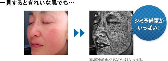 そのシミ シワ たるみ 実は 紫外線 が原因 春の Uv対策 入門 化粧品 コスメの通販 販売 山田養蜂場 そのシミ シワ たるみ 実は 紫外線 が原因 春の Uv対策 入門 化粧品 コスメの通販 販売 山田養蜂場