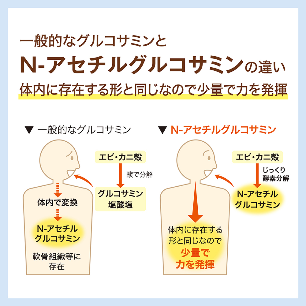 ʓIȃORT~N-AZ`ORT~̈Ⴂ ̓ɑ݂`ƓȂ̂ŏʂŗ͂𔭊