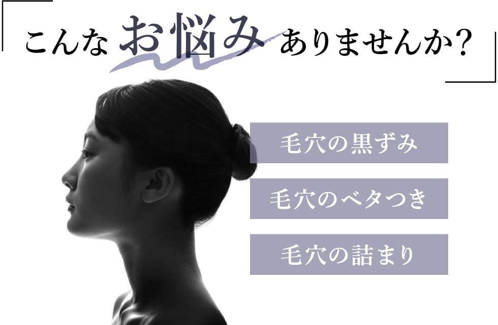 こんなお悩みありませんか? 毛穴の黒ずみ 毛穴の開き 毛穴の詰まり